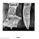 Fig. 08 - ALUMINIUM TOLERANT BARLEY