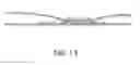 Fig. 12 - Shawl or wrap with closure mechanism