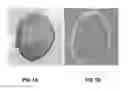 Fig. 02 - Orthotic device for preventing and/or correcting deformational posterior plagiocephaly