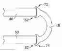 Fig. 01 - CONNECTION SYSTEMS FOR REFRIGERATION FILTER DRYER UNITS AND METHODS FOR THEIR MANUFACTURE