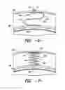 Fig. 06 - SUPPORT BETWEEN TRANSITION PIECE AND IMPINGEMENT SLEEVE IN COMBUSTOR