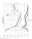 Fig. 04 - PROTECTIVE SHIELD MATERIAL