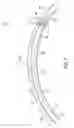 Fig. 08 - Cable-tow system having a stationary support cable