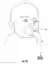 Fig. 19 - Nebulizer that is activated by negative inspiratory pressure