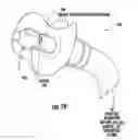 Fig. 20 - Nebulizer that is activated by negative inspiratory pressure