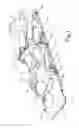 Fig. 02 - Patient positioning system