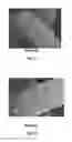 Fig. 03 - Compositions And Methods For Permanent Straightening Of Hair