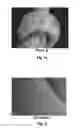 Fig. 04 - Compositions And Methods For Permanent Straightening Of Hair