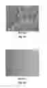 Fig. 06 - Compositions And Methods For Permanent Straightening Of Hair