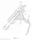 Fig. 06 - HAIR CURLING DEVICE, KIT AND METHOD