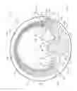 Fig. 03 - Rupture sealing apparatus