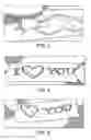 Fig. 03 - DEVICE AND METHOD FOR APPLYING DECORATIVE ELEMENTS