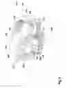 Fig. 05 - Drill hammer and/or chipping hammer device