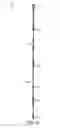 Fig. 03 - Folding high voltage insulating column