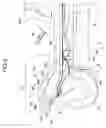 Fig. 04 - Electric riding mower having air-cooled chassis and pivotable protective cowling
