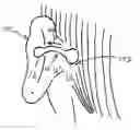 Fig. 01 - HEARING ASSISTANCE DEVICE