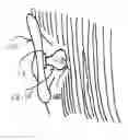 Fig. 01 - Hearing assistance device