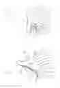 Fig. 04 - Hearing assistance device