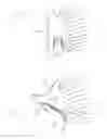 Fig. 04 - Hearing assistance device