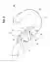 Fig. 06 - Motorcycle exhaust system structure including a resonator provided to an exhaust pipe