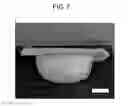 Fig. 08 - Methods to Produce Semi-Durable Foamed Articles