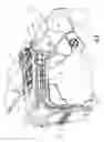 Fig. 09 - Apparatus for dispensing solid articles and methods for using same