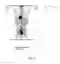 Fig. 03 - Method for optimizing step size in a multi-step whole-body PET imaging