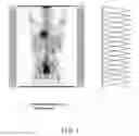 Fig. 04 - Method for optimizing step size in a multi-step whole-body PET imaging