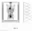 Fig. 05 - Method for optimizing step size in a multi-step whole-body PET imaging