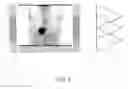 Fig. 06 - Method for optimizing step size in a multi-step whole-body PET imaging