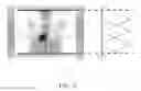 Fig. 07 - Method for optimizing step size in a multi-step whole-body PET imaging