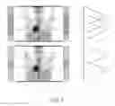 Fig. 08 - Method for optimizing step size in a multi-step whole-body PET imaging