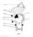 Fig. 06 - Apparatus for flow control and shutoff