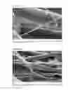 Fig. 06 - Pleatable nonwoven material and method and apparatus for production thereof