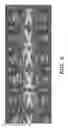 Fig. 06 - Polymer stents and methods of manufacture