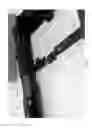 Fig. 06 - Fore-aft vibration isolator