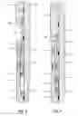 Fig. 03 - Metal sealing adjustable casing sub