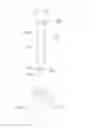 Fig. 01 - SEAL-LOCK WITH DESTRUCTION-IDENTIFYING STRUCTURE