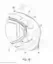Fig. 03 - LED light bulb equipped with light transparent shell fastening structure