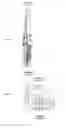 Fig. 01 - Spark plug and process for producing spark plug
