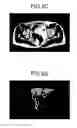 Fig. 07 - Combining multiple MRI data acquisitions having different B1 inhomogeneities