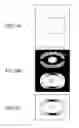 Fig. 16 - Combining multiple MRI data acquisitions having different B1 inhomogeneities
