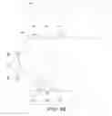 Fig. 89 - OPTICAL TOUCH SCREEN WITH TRI-DIRECTIONAL MICRO-LENSES