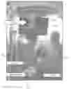 Fig. 01 - CONCEPT OF SUPERIMPOSING AN INTRAOPERATIVE LIVE IMAGE OF AN OPERATING FIELD WITH A PREOPERATIVE IMAGE OF THE OPERATING FIELD