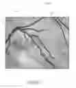Fig. 05 - CONCEPT OF SUPERIMPOSING AN INTRAOPERATIVE LIVE IMAGE OF AN OPERATING FIELD WITH A PREOPERATIVE IMAGE OF THE OPERATING FIELD