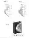 Fig. 04 - Imaging method with improved display of a tissue region, imaging device, and computer program product