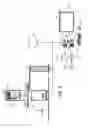Fig. 05 - Ring gantry radiation treatment delivery system with dynamically controllable inward extension of treatment head