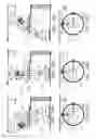 Fig. 14 - Ring gantry radiation treatment delivery system with dynamically controllable inward extension of treatment head