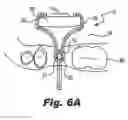 Fig. 08 - SENSOR POSITIONING AND STABILIZING DEVICE