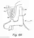 Fig. 09 - SENSOR POSITIONING AND STABILIZING DEVICE